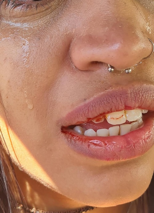 Em Ponta Porã, venezuelano espanca mulher, rouba o celular e é preso em flagrante pela GCMFRON Em Ponta Porã, venezuelano espanca mulher, rouba o celular e é preso em flagrante pela GCMFRON