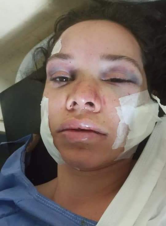 Fronteira: Homem tenta matar a ex namorada a facadas, foge e é preso Fronteira: Homem tenta matar a ex namorada a facadas, foge e é preso