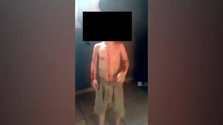 Pais de menino filmado cheio de sangue agora fogem de "justiceiros" Pais de menino filmado cheio de sangue agora fogem de "justiceiros"