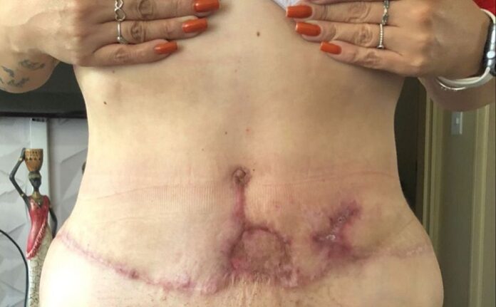 cirurgia-plastica-1