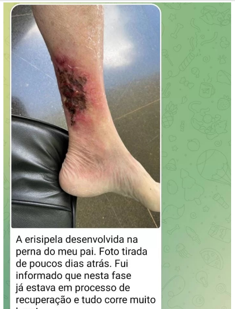 Erisipela: Filho de Bolsonaro mostra pai com ferimento na perna Erisipela: Filho de Bolsonaro mostra pai com ferimento na perna
