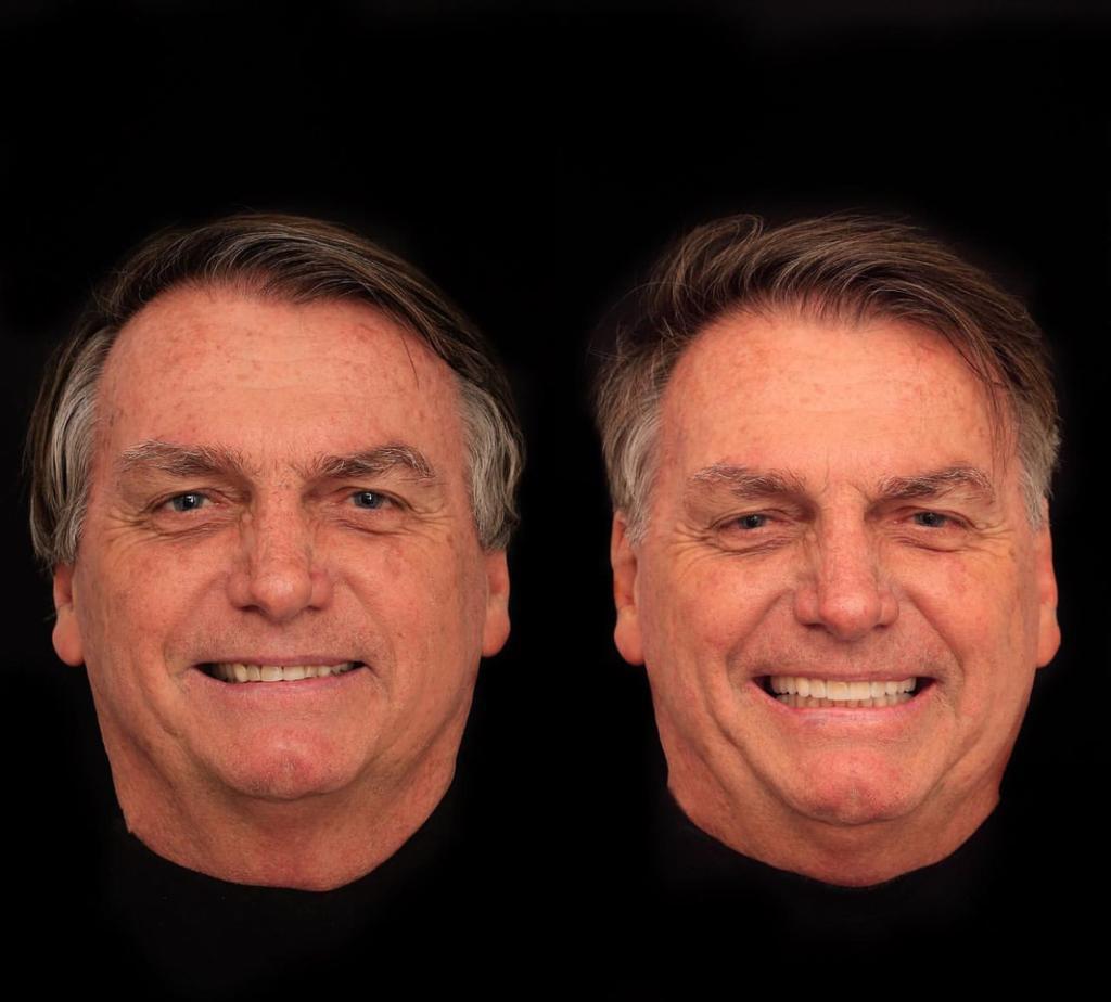 Bolsonaro faz procedimento estético em clínica de Goiânia; veja antes e depois Bolsonaro faz procedimento estético em clínica de Goiânia; veja antes e depois
