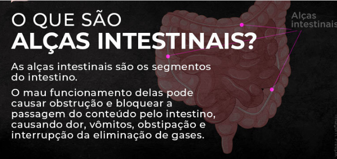 Bolsonaro passa por novo procedimento em hospital do DF por desconforto intestinal