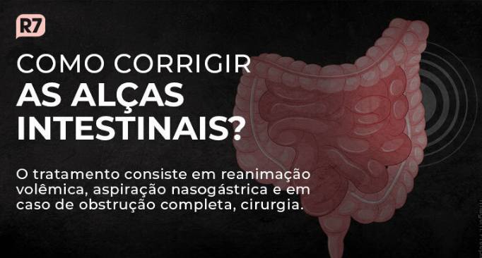 Bolsonaro passa por novo procedimento em hospital do DF por desconforto intestinal
