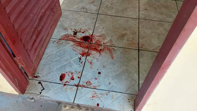 Segurança de ONG afirma que agiu em legítima defesa ao esfaquear rapaz Segurança de ONG afirma que agiu em legítima defesa ao esfaquear rapaz