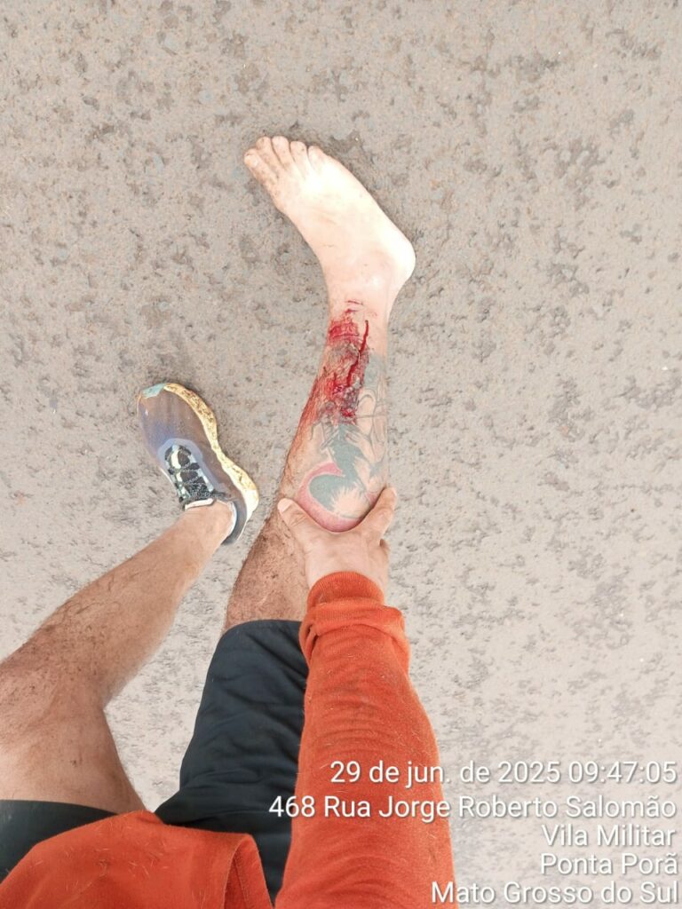 Mestre de Muay Thai é atacado por dois pitbulls em Ponta Porã e faz alerta à população Mestre de Muay Thai é atacado por dois pitbulls em Ponta Porã e faz alerta à população