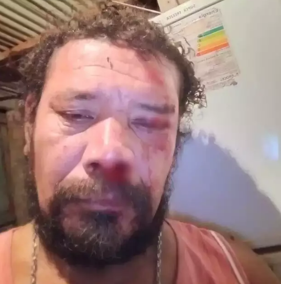 Após avaliar caso, instituto garante que onça não atacou homem em Corumbá Após avaliar caso, instituto garante que onça não atacou homem em Corumbá