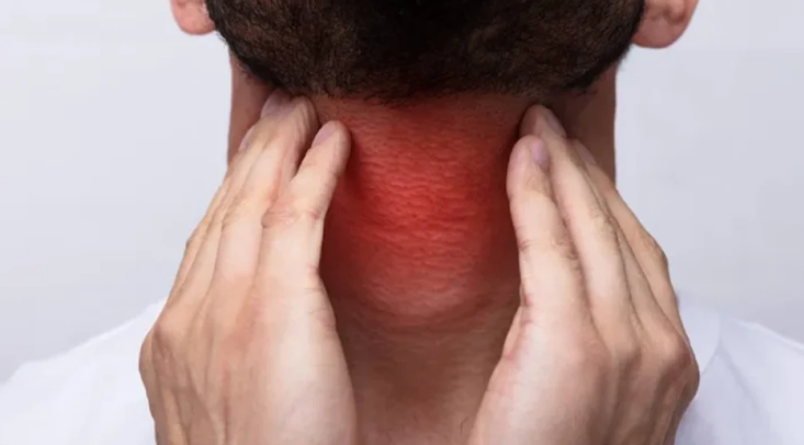 Cáncer de Cabeza y Cuello: Afecta más a hombres mayores, aunque aumentan casos en jóvenes Cáncer de Cabeza y Cuello: Afecta más a hombres mayores, aunque aumentan casos en jóvenes