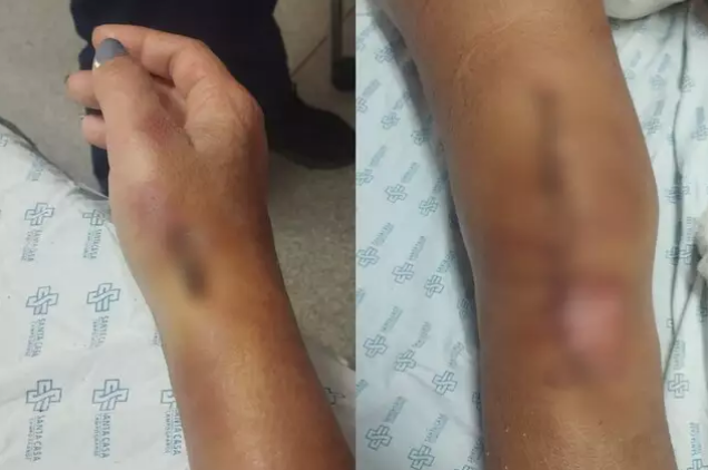 “Vi o clarão e apaguei, mas sabia que era ele”, diz mulher atropelada pelo ex “Vi o clarão e apaguei, mas sabia que era ele”, diz mulher atropelada pelo ex