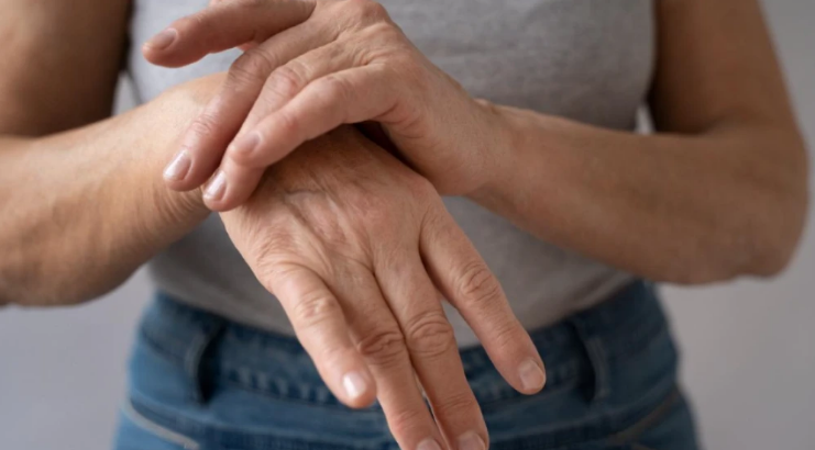El Lupus afecta más a mujeres de entre 20 y 30 años: ¿cuáles son sus principales síntomas? El Lupus afecta más a mujeres de entre 20 y 30 años: ¿cuáles son sus principales síntomas?
