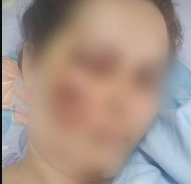 “Vi o clarão e apaguei, mas sabia que era ele”, diz mulher atropelada pelo ex “Vi o clarão e apaguei, mas sabia que era ele”, diz mulher atropelada pelo ex