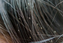 Template Colunistas – Yhuldes Giovani