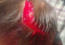 Template Colunistas – Yhuldes Giovani