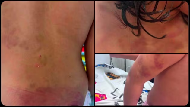 Imputan a la madre y padrastro de niña con TEA que fue brutalmente agredida en PJC Imputan a la madre y padrastro de niña con TEA que fue brutalmente agredida en PJC