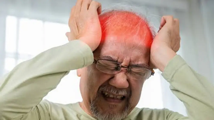 Migraña: Su mayor impacto se observa durante la edad adulta joven, entre 20 y 50 años