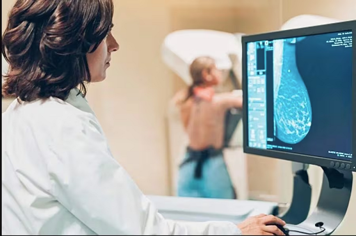 Paraguay reduce casi 20 % las muertes por cáncer de mama en cinco años