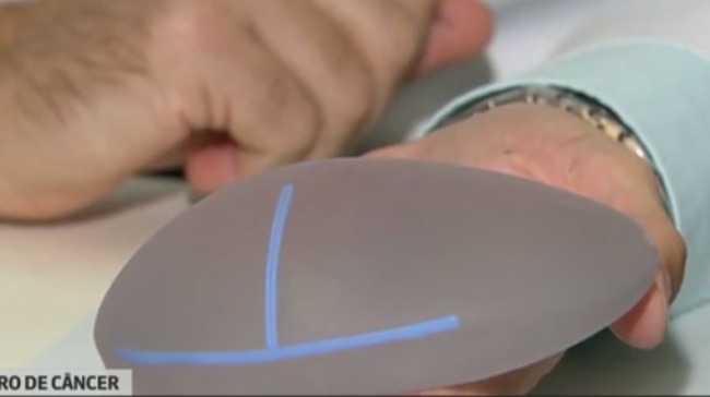 Fabricante de um tipo de implante de silicone amplia recall do produto